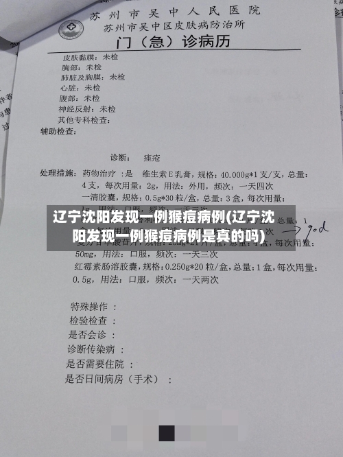 辽宁沈阳发现一例猴痘病例(辽宁沈阳发现一例猴痘病例是真的吗)-第3张图片