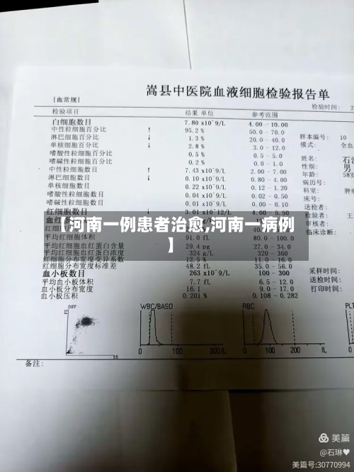 【河南一例患者治愈,河南一病例】-第3张图片